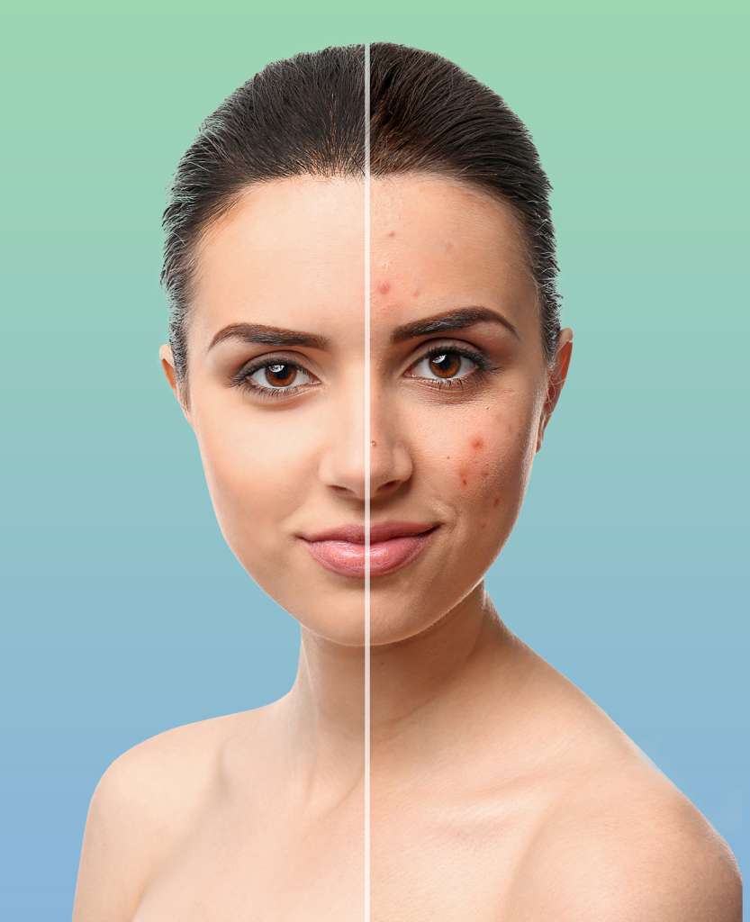 Acne & Scar Treatment 1 Rejuvenation Center in Bentonville, Arkansas