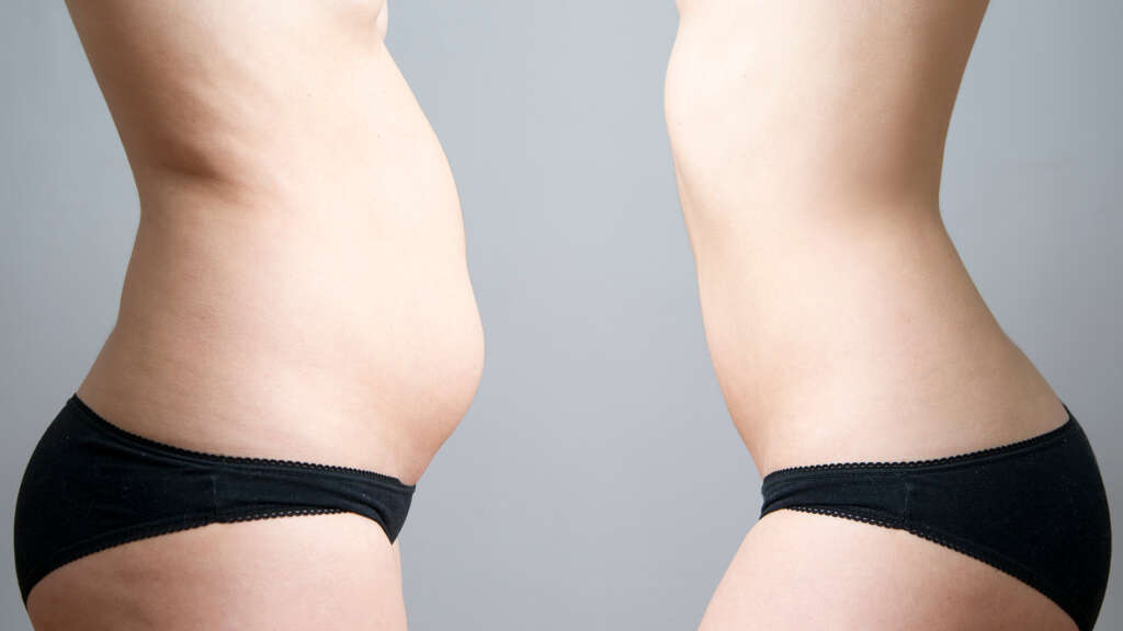 glp-1 weight loss bentonville Semaglutide FDA Weightloss Approval